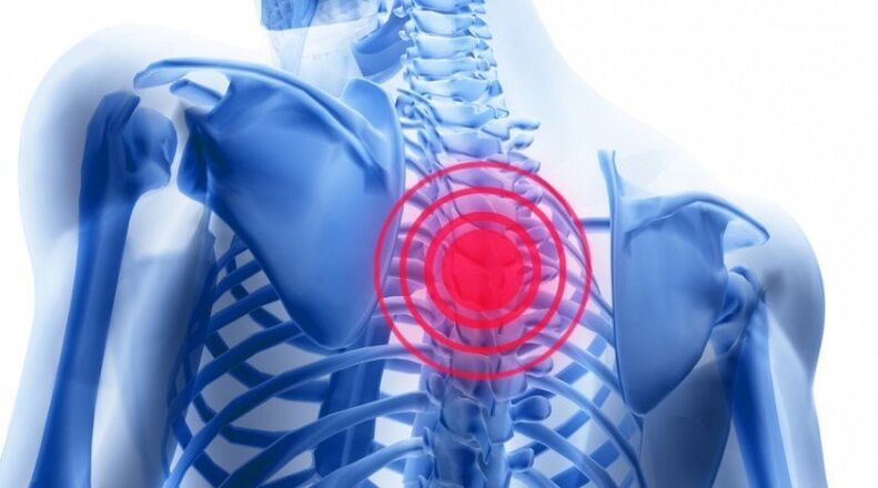 Back pain can be associated with a herniated disc. 