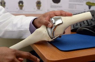 The total knee replacement of